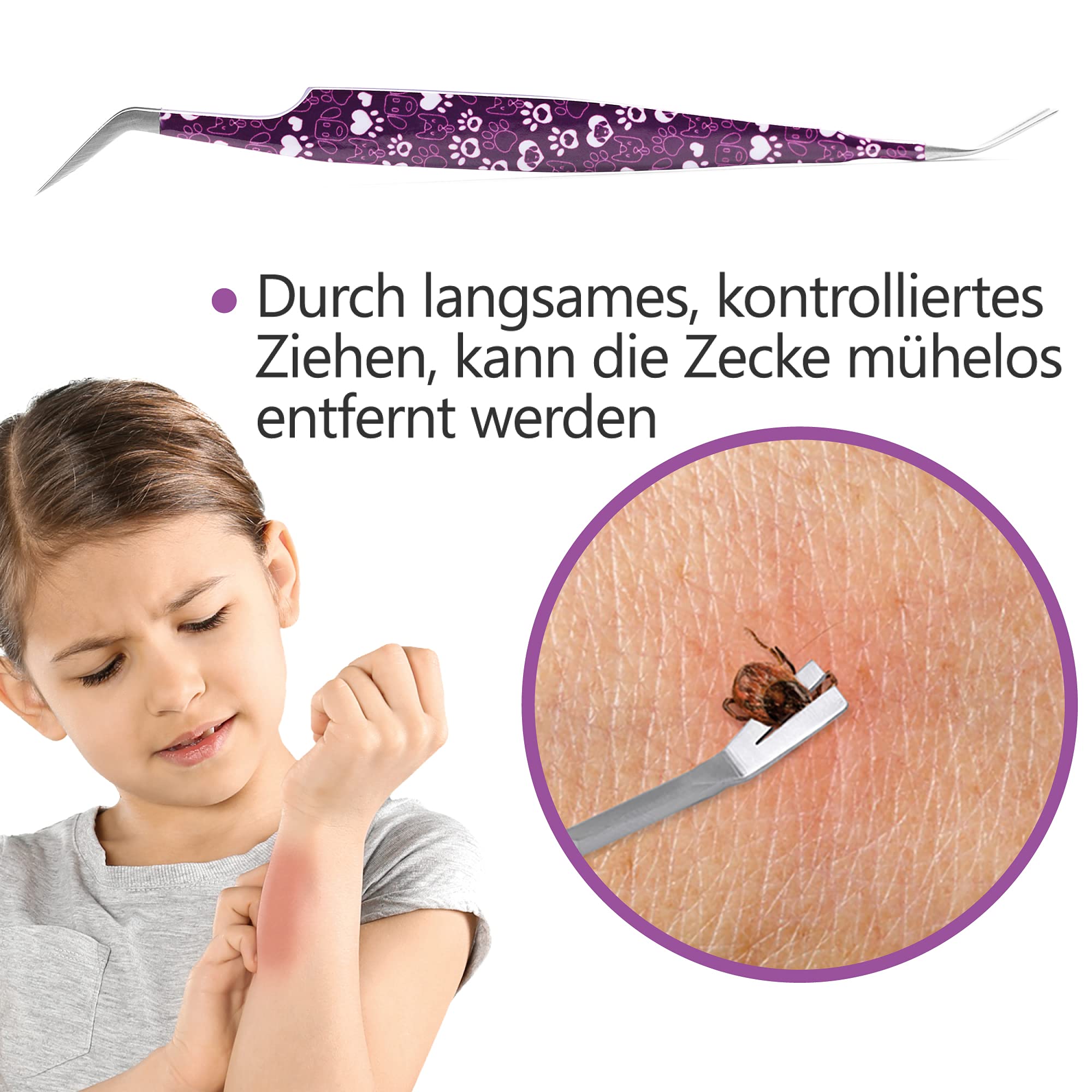 2-in-1 Profi Zeckenzange - für Hunde und Katzen - Violett