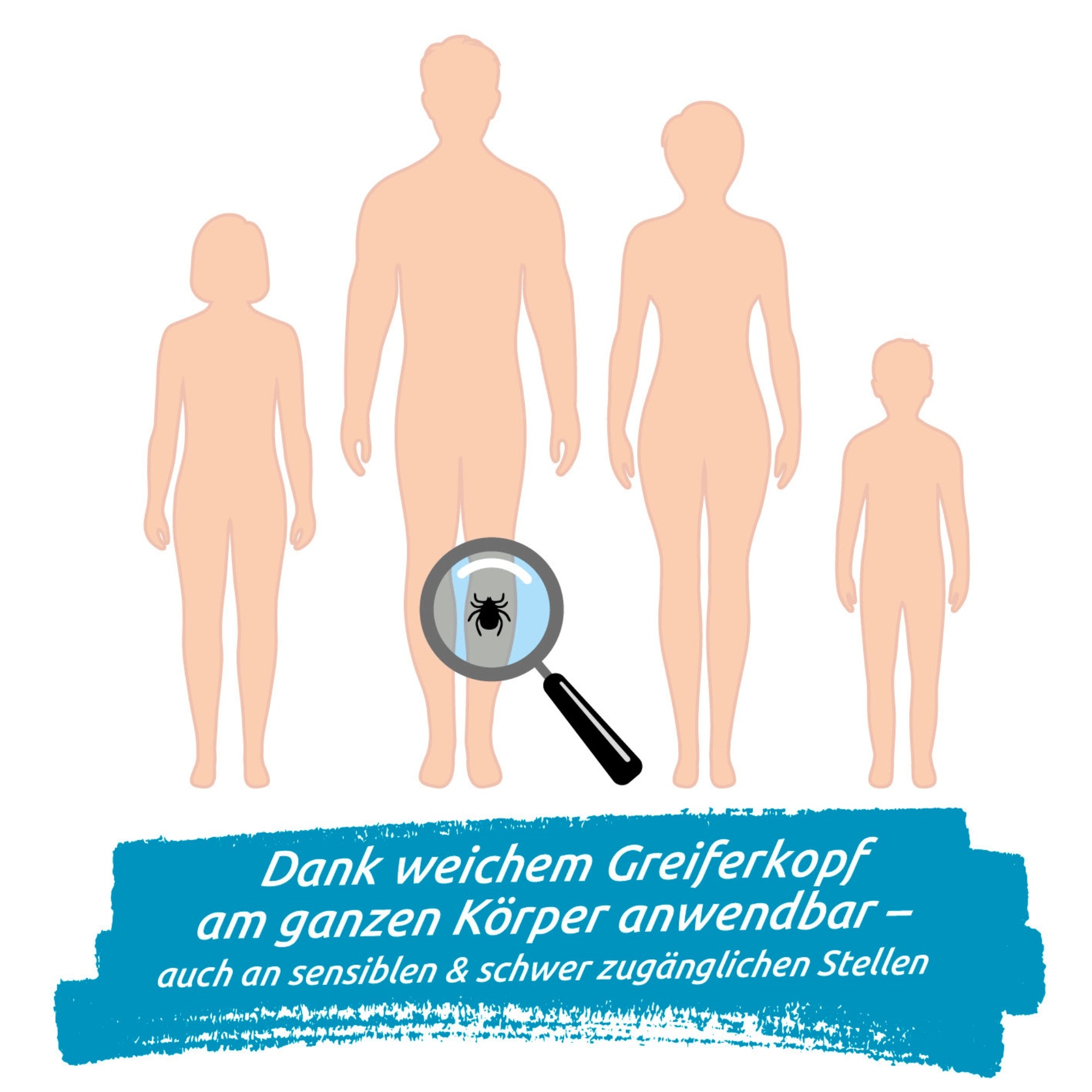 Illustration zeigt Anwendung des Zeckengreifers für Menschen mit rotierendem Greiferkopf an sensiblen Körperstellen bei Familie.