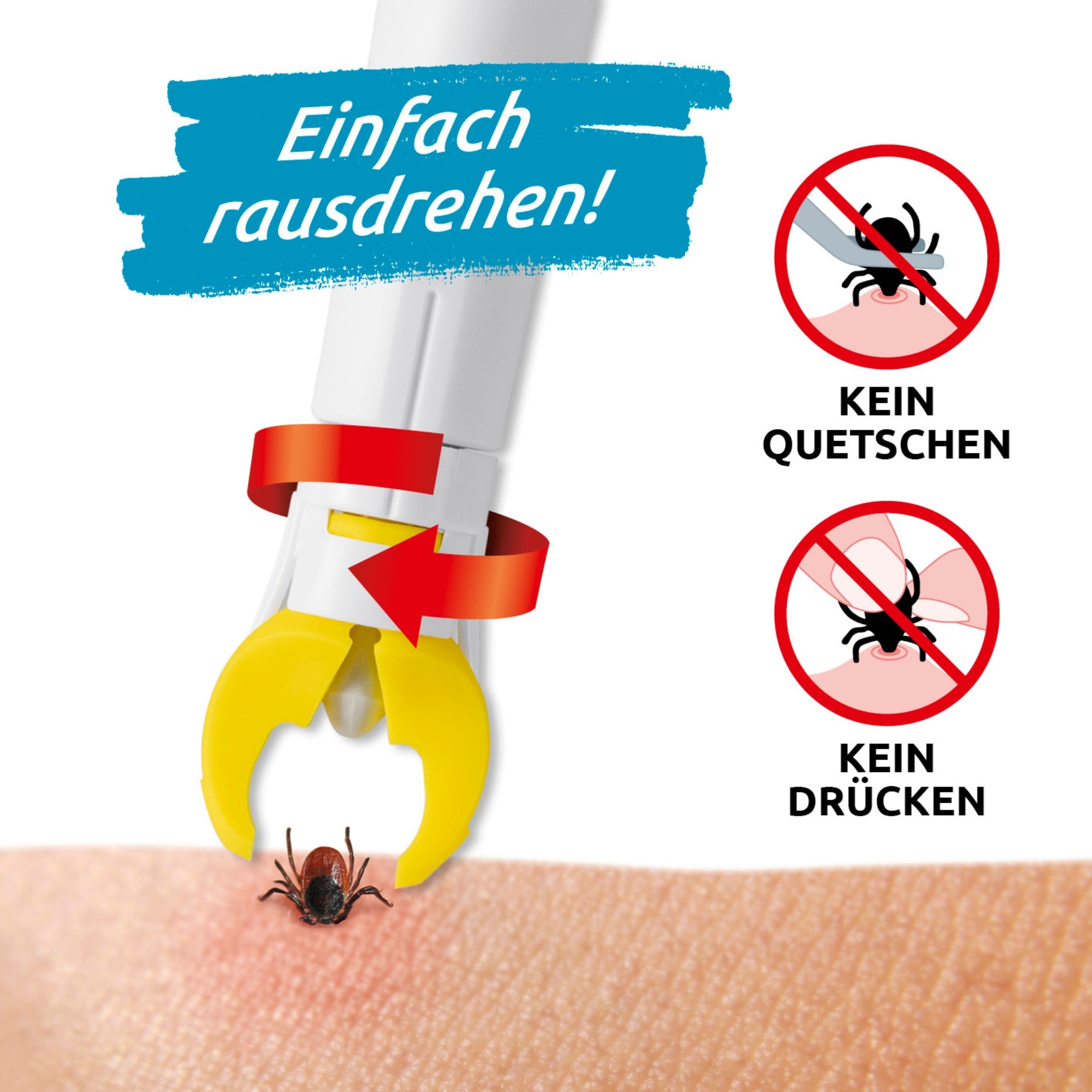 Zeckengreifer für Menschen mit rotierendem Greiferkopf entfernt Zecken sanft ohne Quetschen durch präzise Drehtechnik am Körper.