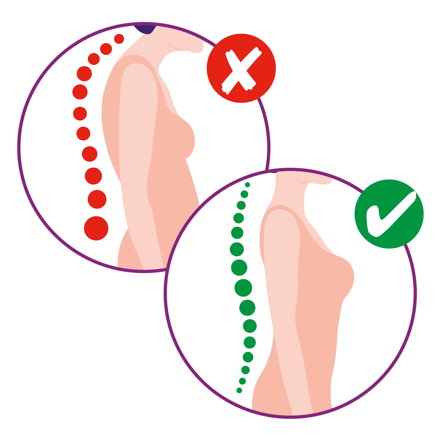 Illustration zeigt Rücken mit schlechter und korrekter Haltung, ideal für Rückenkorrektor - S/M - creme zur Haltungskorrektur.