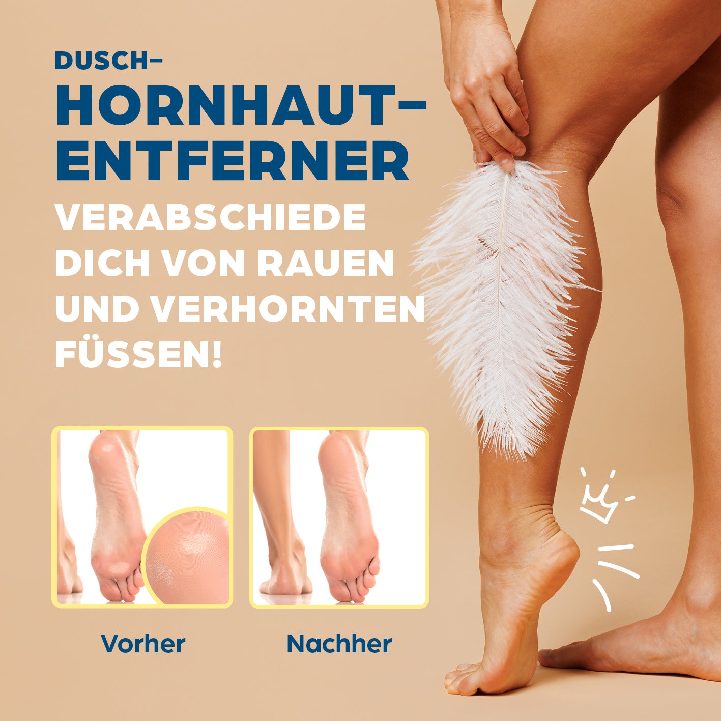 Hornhautentferner für die Dusche - Gold-Edition entfernt mühelos Hornhaut unter der Dusche für glatte, gepflegte Füße.