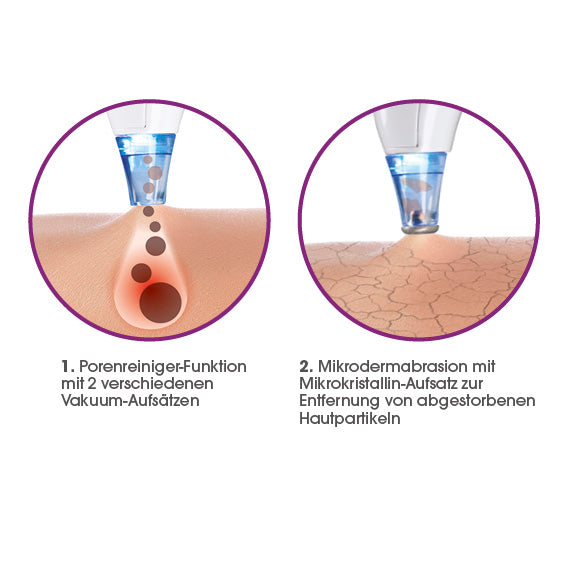 Porenreiniger 5-tlg. mit Aufsatz für Mikrodermabrasion zeigt porentiefe Reinigung und Entfernung abgestorbener Hautpartikel mit Mikrokristallin-Aufsatz.