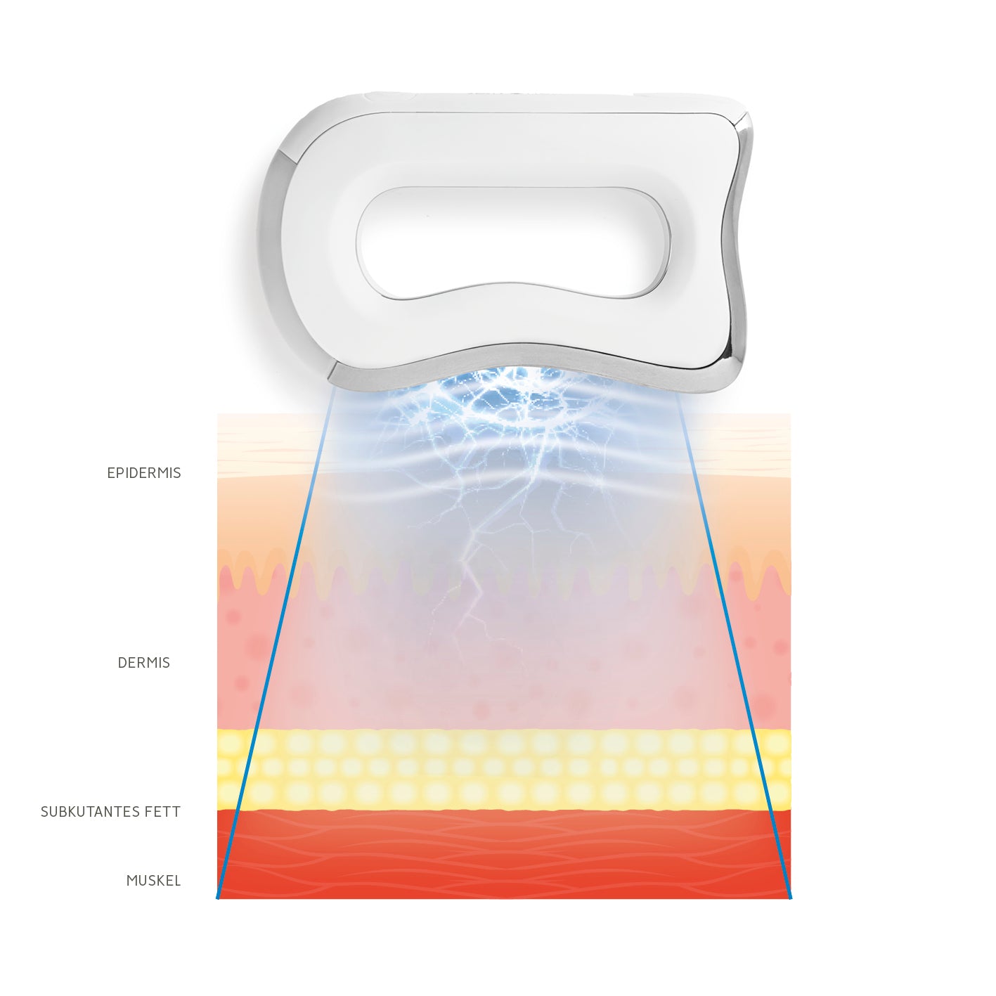 EMS-Massagegriff - 3 Intensitätsstufen und Wärmefunktion zeigt Anwendung mit Mikrovibration und EMS für tiefe Muskelentspannung.